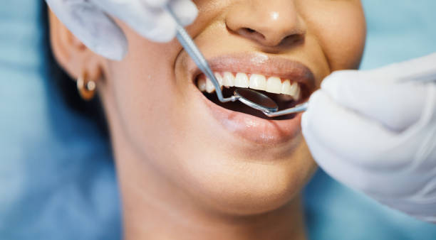 Best After-Hours Emergency Dentist in Earlvle, IL